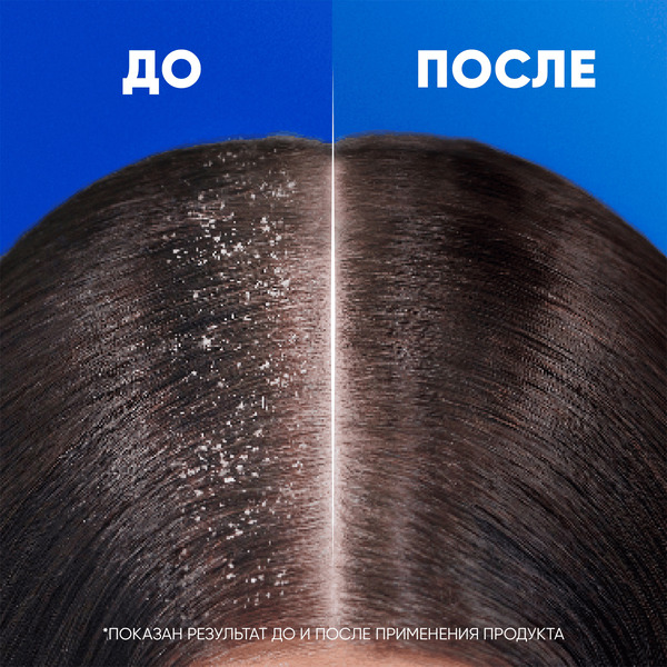 Шампунь для волос Head & Shoulders против выпадения волос, 360 мл