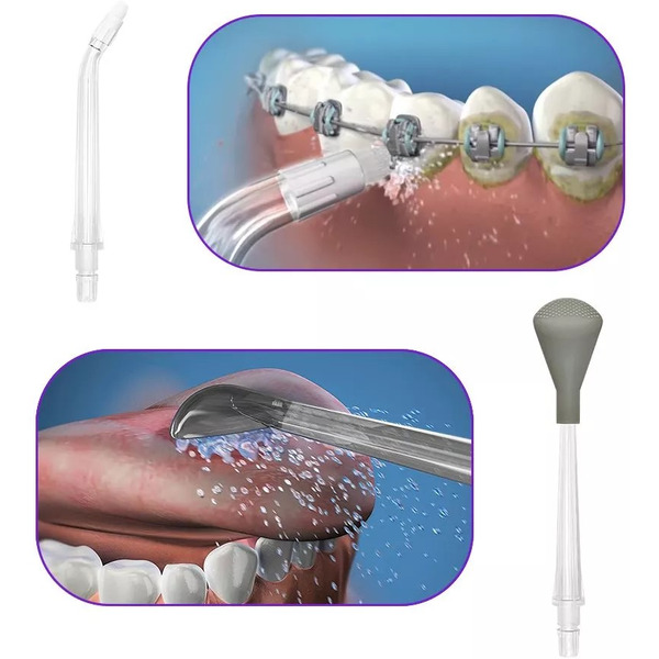 Ирригатор Kitfort КТ-2940-3