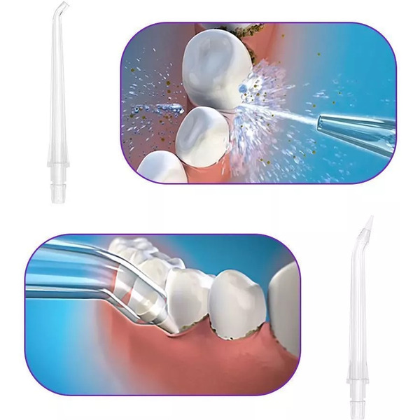 Ирригатор Kitfort КТ-2940-3